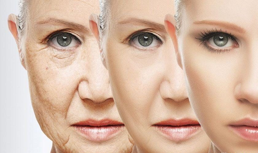 خرید و قیمت کرم ضد چروک ویچی Vichy Anti-Wrinkle Cream تولید امارات برای سفت‌کننده و جوان‌سازی پوست