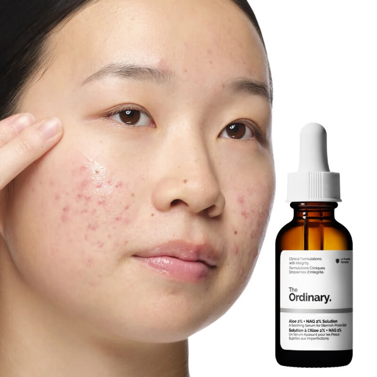 سرم آلوئه + NAG اوردینری (The Ordinary Aloe + NAG Serum) مناسب برای تسکین، آبرسانی و شادابی پوست