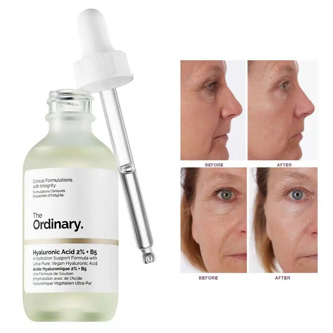 سرم هیالورونیک اسید اوردینری The Ordinary Hyaluronic Acid 2% + B5  مناسب برای آبرسانی عمیق، حفظ رطوبت و افزایش نرمی و لطافت پوست